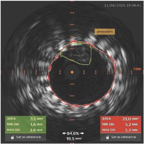 Изображение на обложке